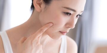 3 Tips Atasi Jerawat Pustula Akibat Pori-Pori Tersumbat, Dijamin Work!